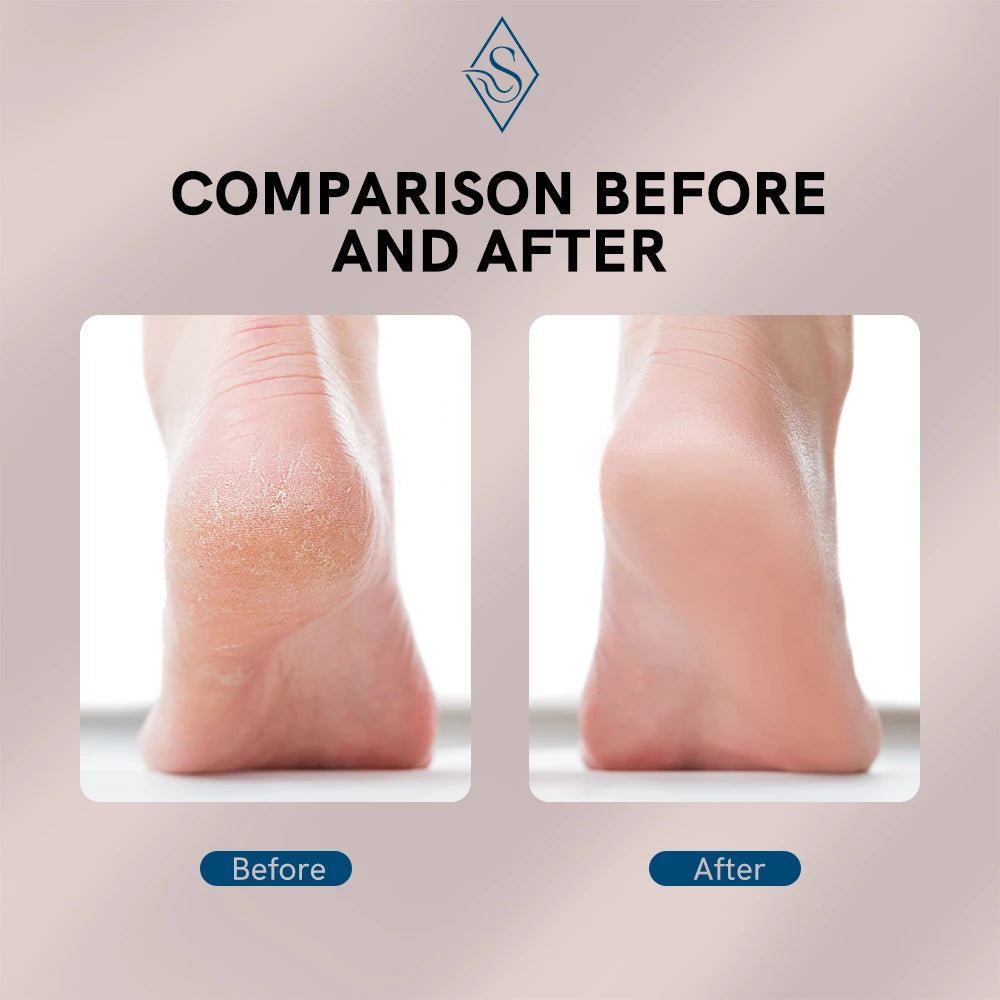 Homezore™ Electric Foot File