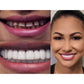 Homezore™ Magical Teethbrace Set (Upper & Lower Teeth)