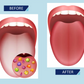 Homezore™ Oral Care Kit